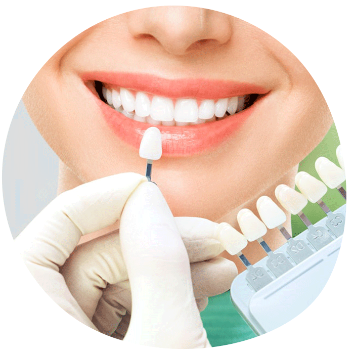 https://lovemysmiledental.ca/wp-content/uploads/2022/09/whitenning.png